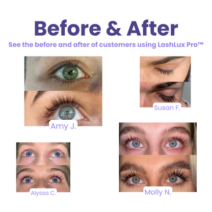 Last Day Sale 🔥 I LashLux Pro™ Eyelash Growth Serum